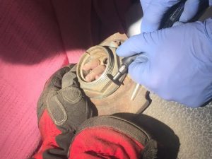 Toddler fingers freed from bath drain